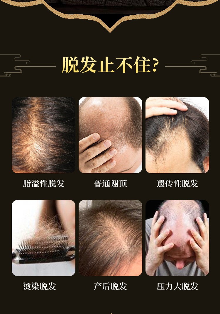【修正】大发师防脱育发液密发防脱发护理发液养生长发固发浓密增